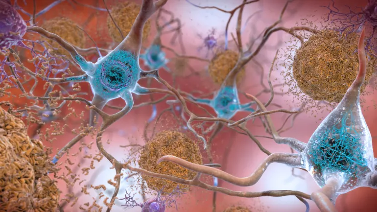 FDA Clears Roche and Eli Lilly's Alzheimer's Blood Test for Broad Clinical Use