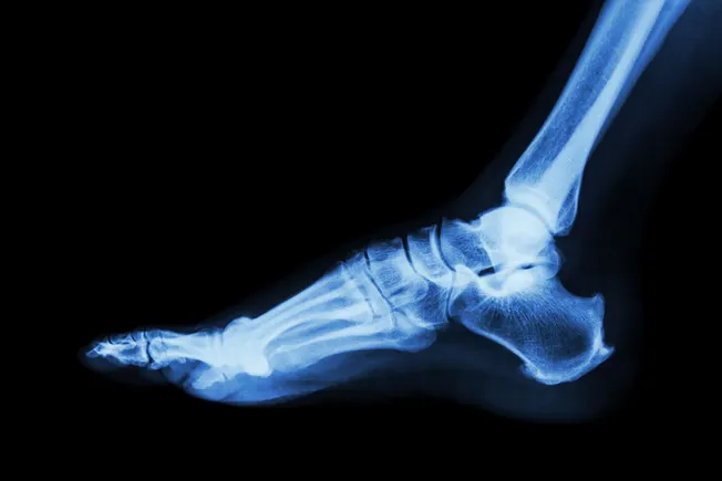 Teledyne拟以11亿美元收购Varex Imaging,加码医疗影像布局