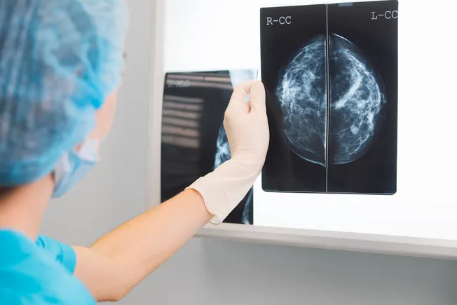 Vara receives CE mark for first autonomous breast cancer screening