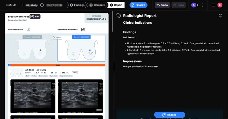 DeepHealth 获 FDA 510(k) 许可：AI 工具可解读乳腺超声并自动生成报告