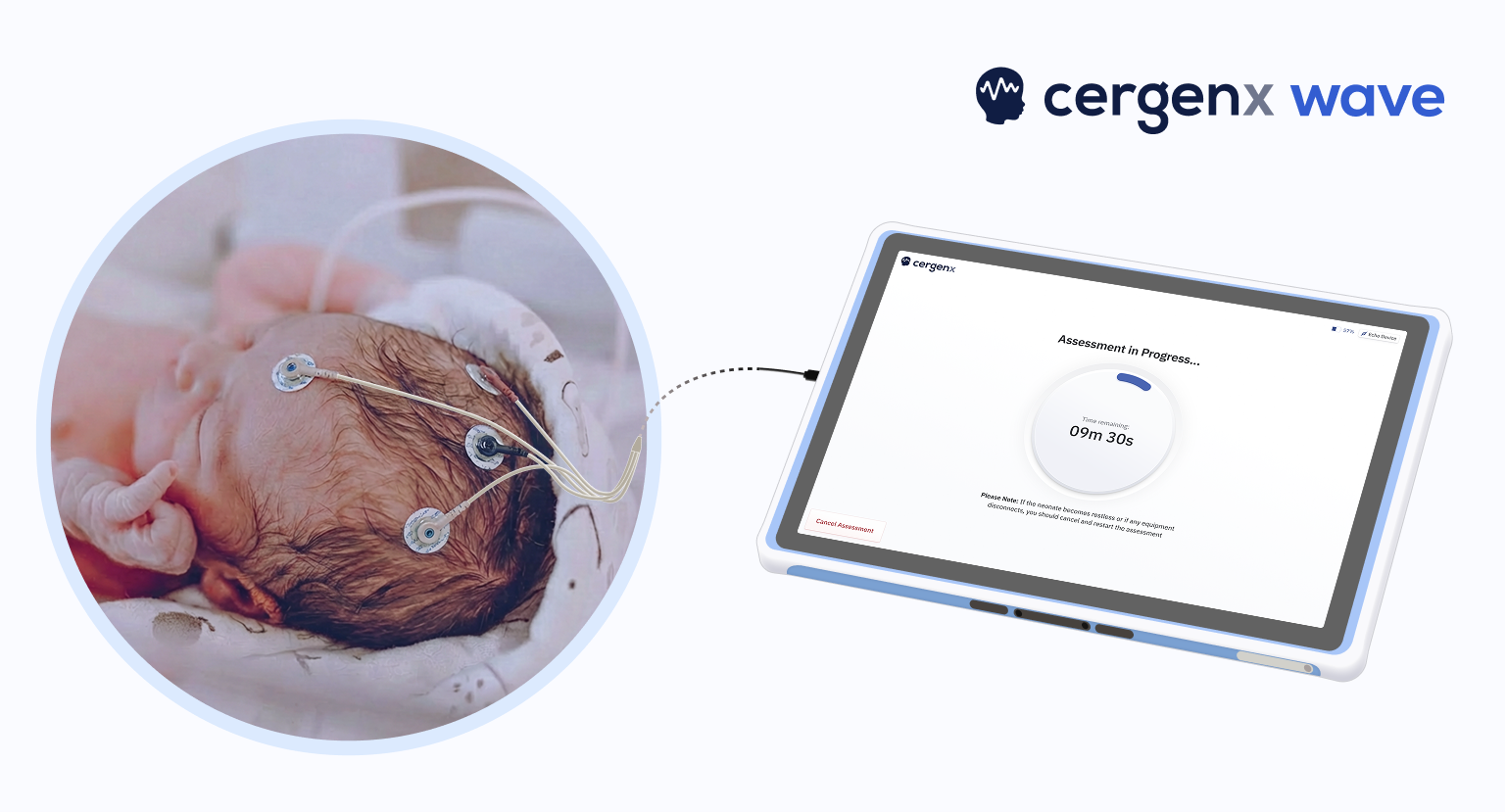 CergenX 旗下新生儿脑功能AI评估系统 Wave 获欧盟 CE 认证